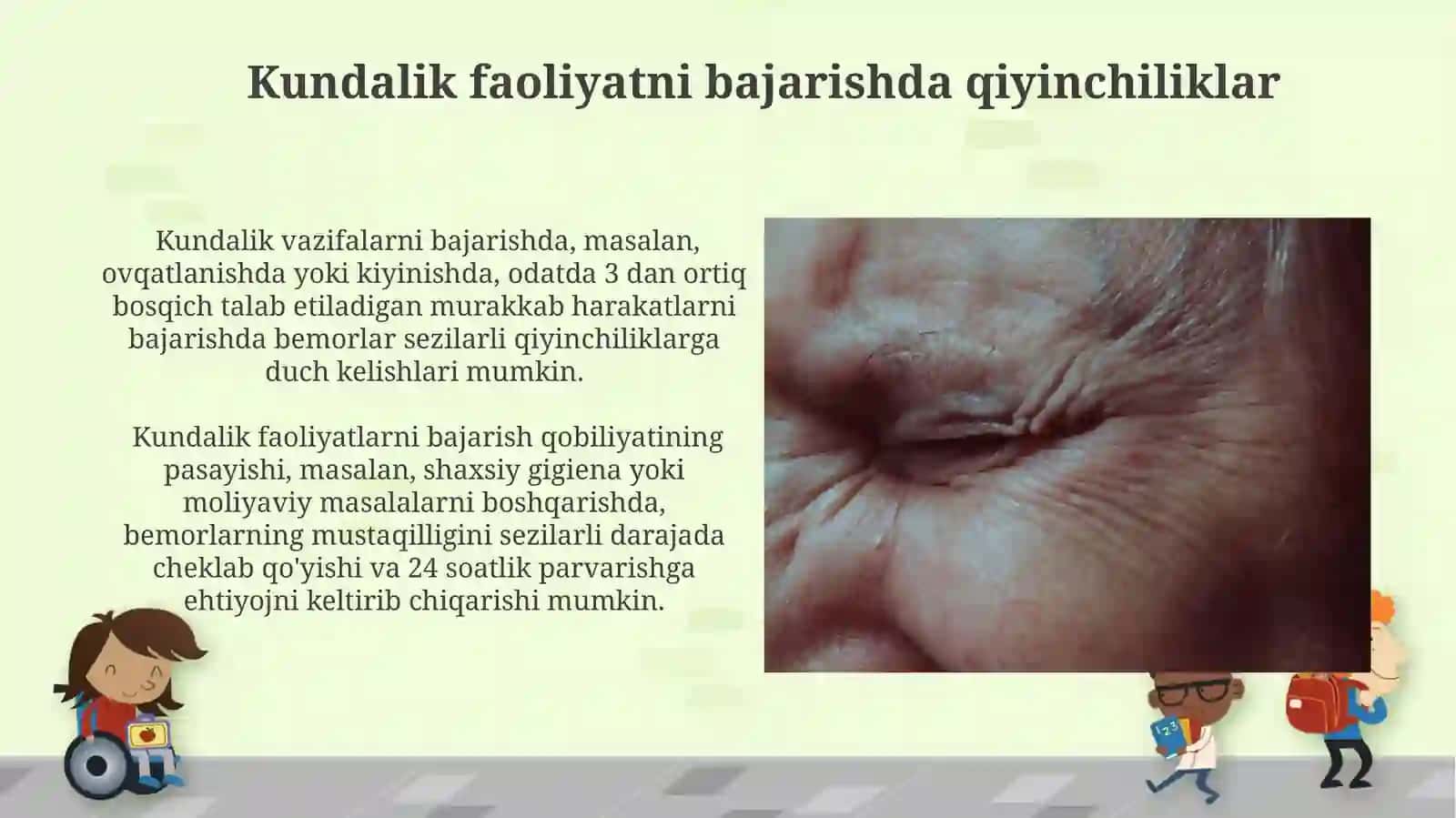 Demensiya: klinik ko‘rinishdagi demensiyaning xususiyatlari 3