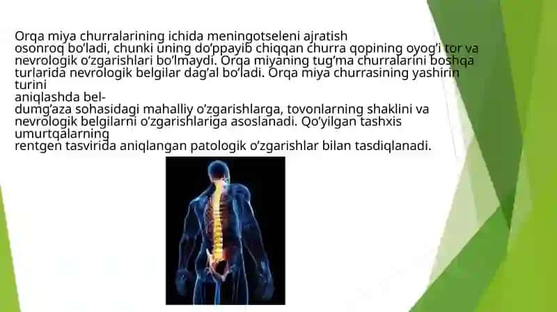 Orqamiyachurralarida operatsiya 3
