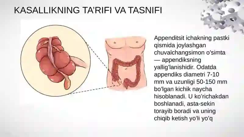 Appenditsit — Ta’rifi, Tasnifi, Belgilari va Alomatlari, Tashxislash va Davolash 3