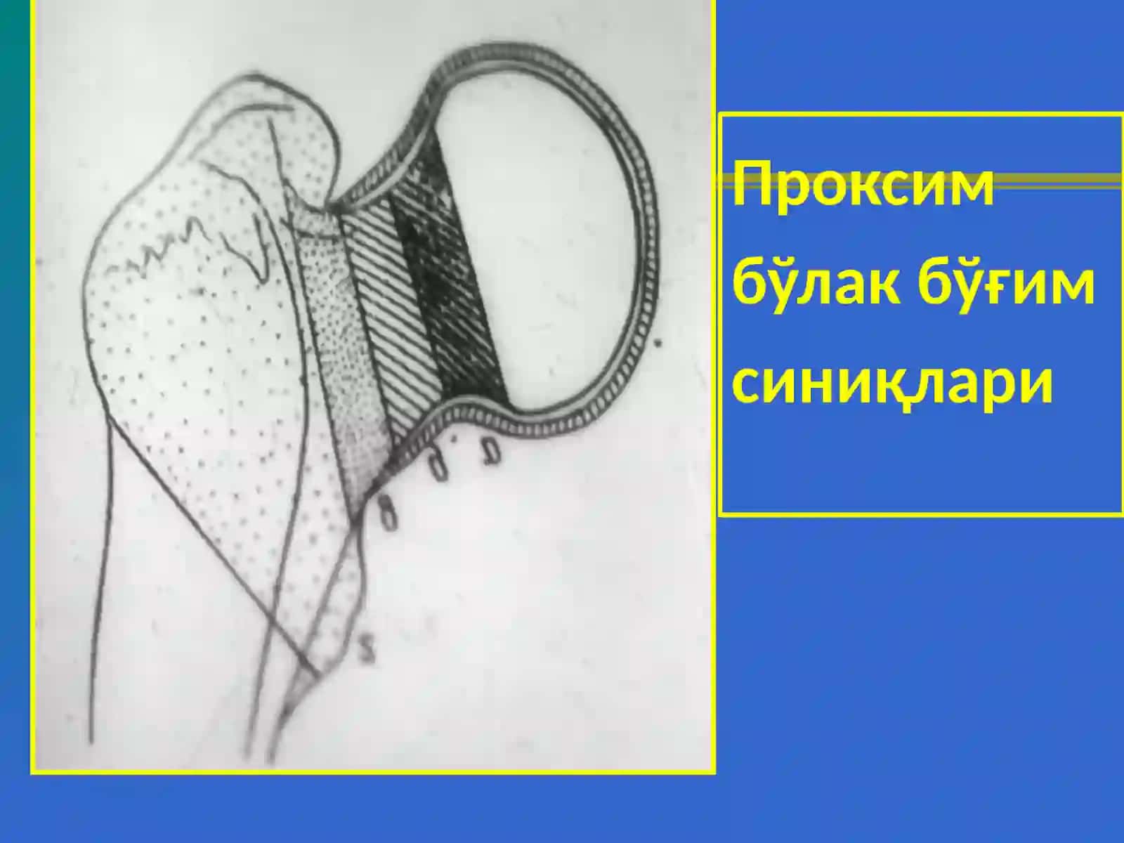 Сон,тизза,болдир ваоёқ панжа шикастлари 3