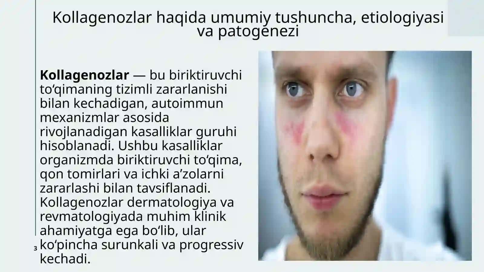 Kollagenozlar, disxromiyalar, sklerodermiya, qizilyugurik, vitiligo, xloazma va lentigo 3
