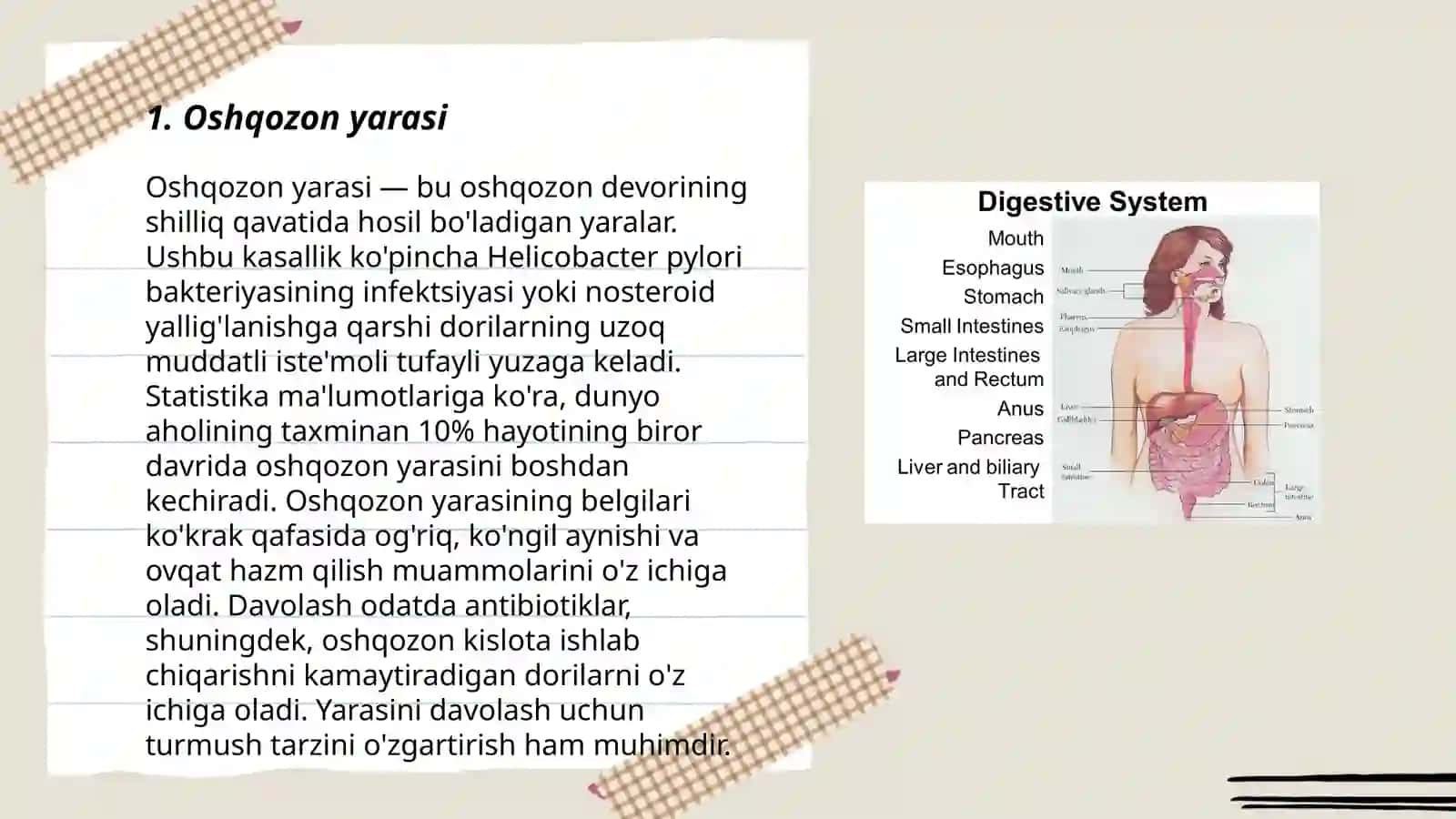 Oshqozon yarasi 3