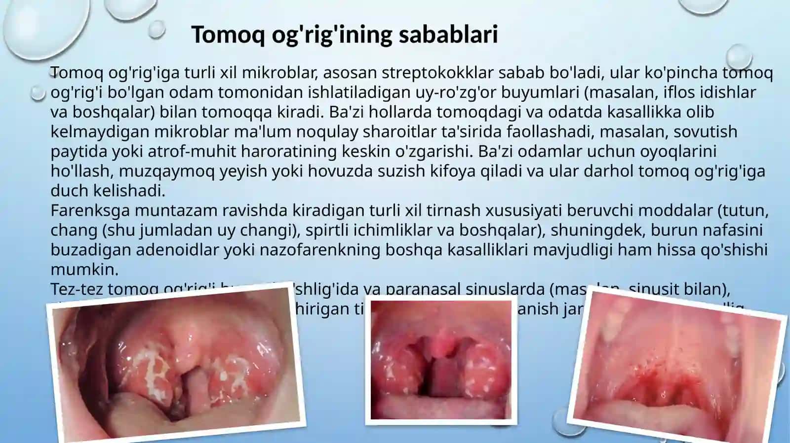 Angina va uning asoratlari 3