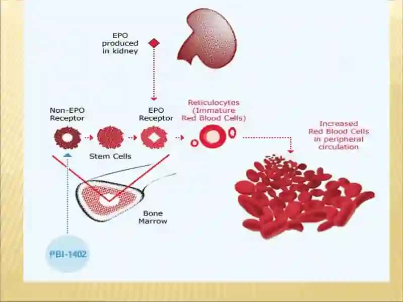 Blood smear analysis for sickle-cell anemia 3
