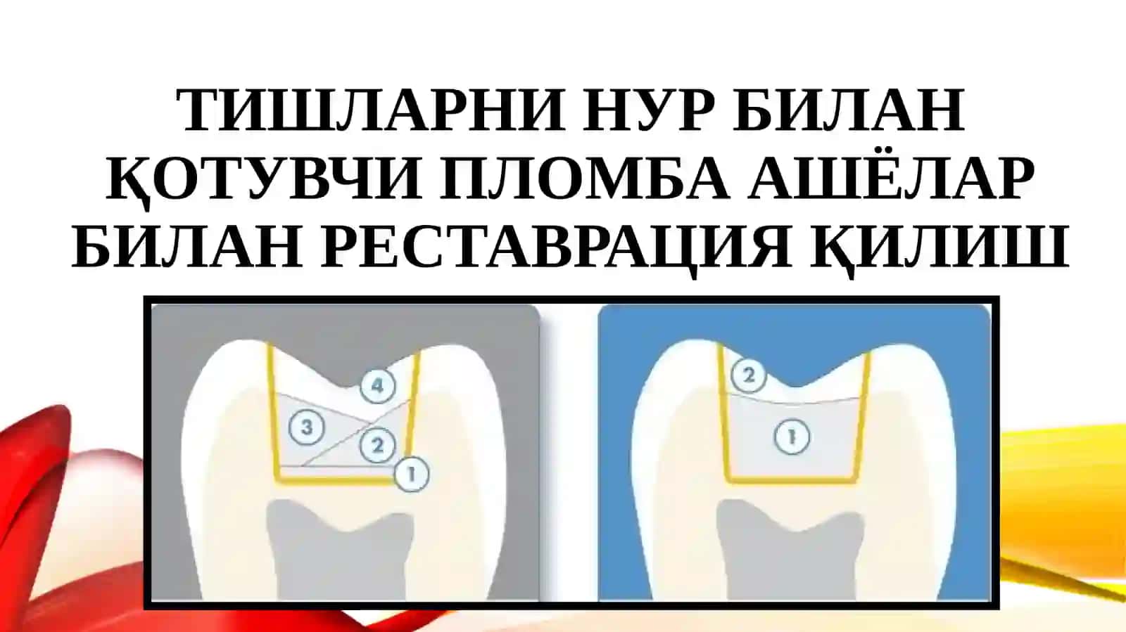 Tish qattiq toʻqimasini zamonaviy kompozit ashyolari bilan restavratsiya qilishning asosiy bosqichlari. Koʻrsatma va qarshi koʻrsatmalar(slayd/ prezintatsiya/ mustaqil ish/ taqdimot) tibbiyot 3