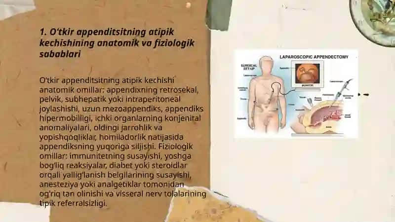 Oʻtkir appenditsit atipik kechishi 3