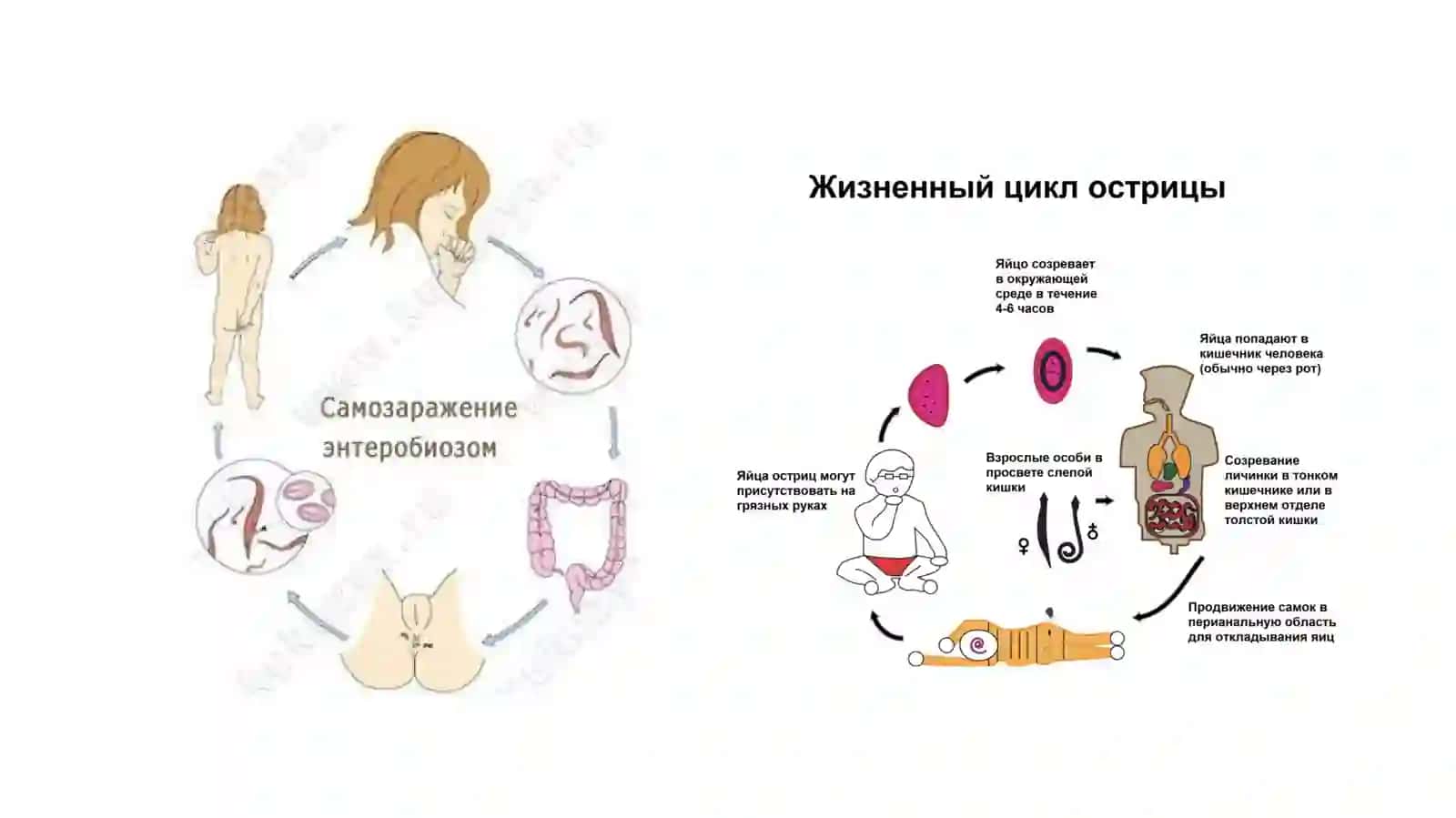 Enterobioz (Ostritsa) 3
