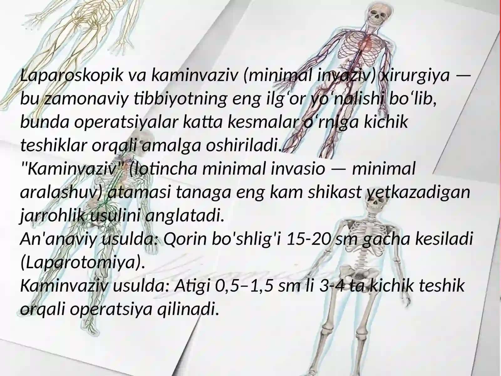 Laparoskopik xirurgiya. Laparoskopik splenektomiya. Oshqozon osti bezi xirurgiyasi 3