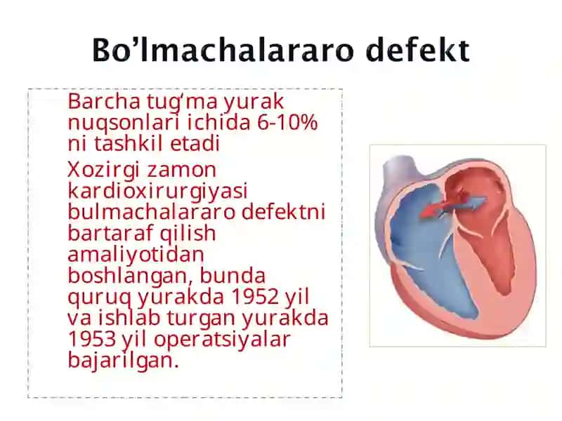 Tug‘ma yurak nuqsonlari embronal davirdagi rivojlanishdagi buzilishlar 3