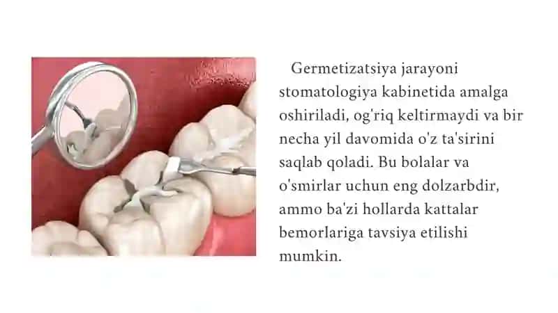 FISSUR GERMETIKLAR 3