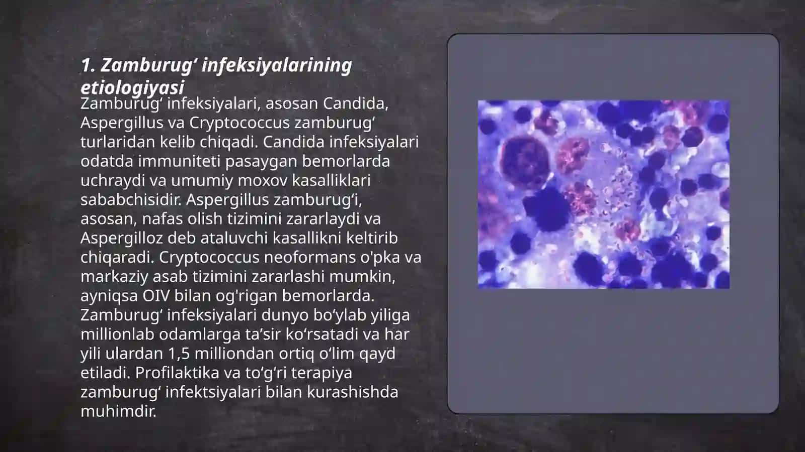 Zamburugʻ va parazitar infeksiyalar etio-patagenezi, marfologiyasi 3