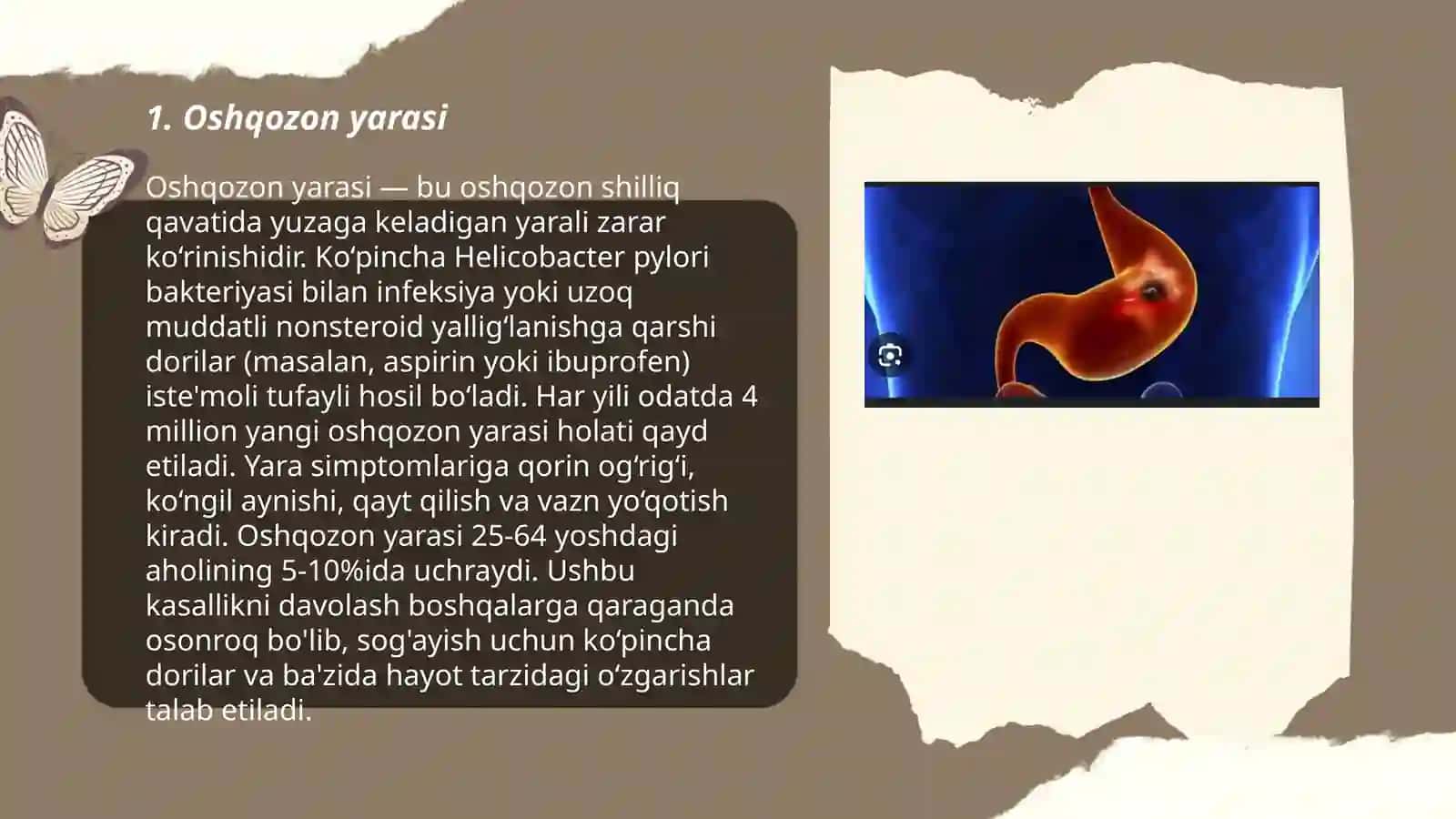 Oshqozon raki sabablari va belgilari 3