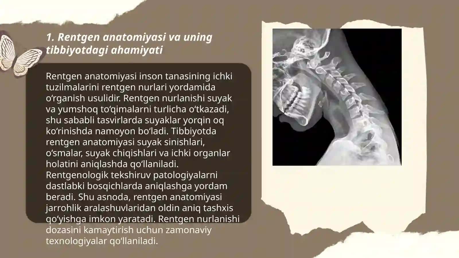 Tishlarning rentgen anatomiyasi 3