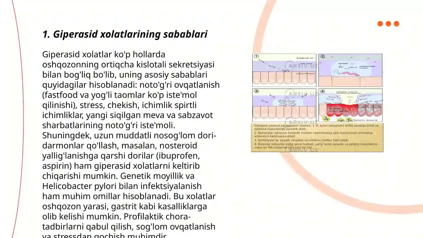 Giperasid xolatlarda va oshqozon yara kasalliklarida antasid vositalar 3