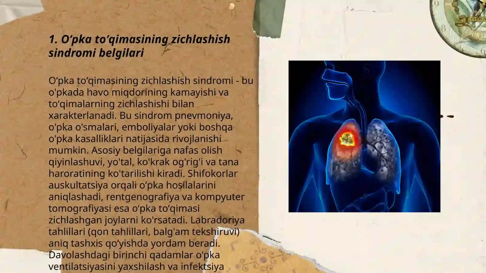 Oʻpka toʻqimasining zichlashish sindromi 3