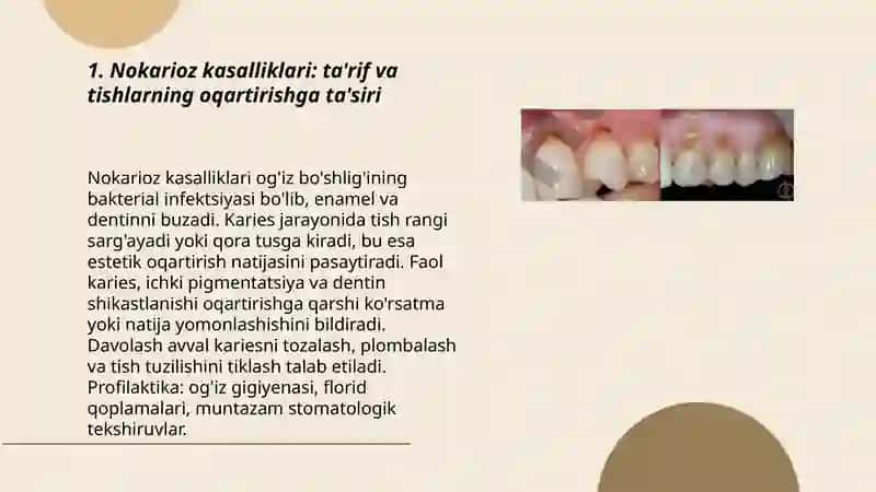 Nokarioz kasalliklarida tishlarni oqartirish prinsiplari 3