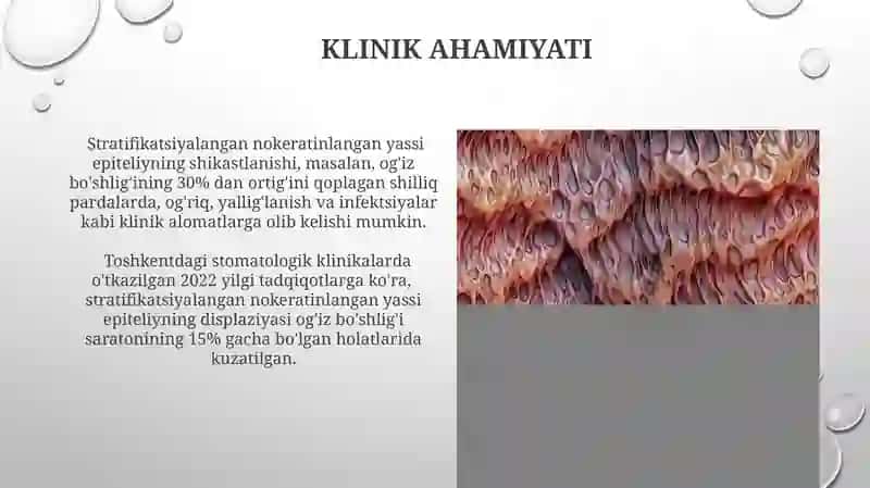 Qatlamli Note'kilsiz Yassi Epiteliyning Tuzuilishi 3