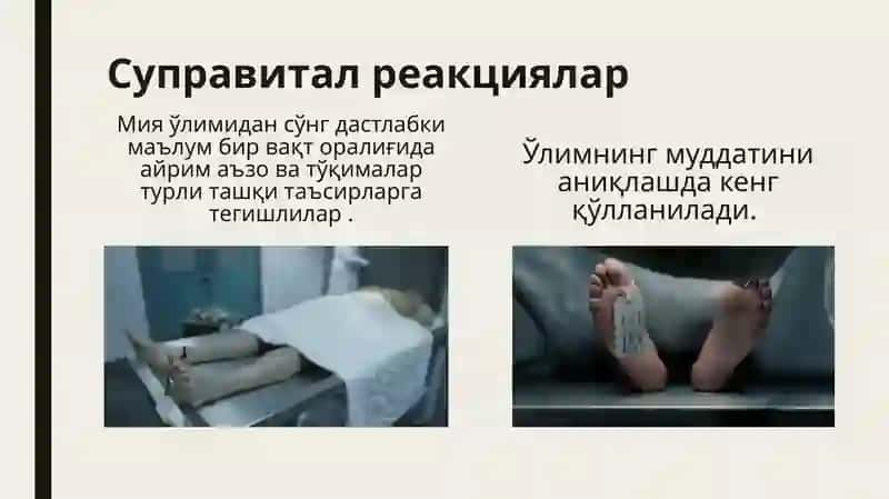 Суправитал реакциялар 3