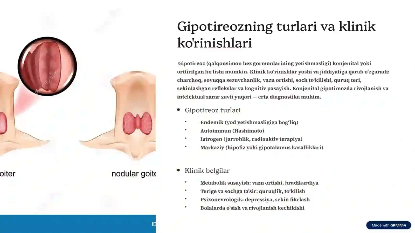 Endemik buqoq va gipotireoz: patogenezi va davolash usullari 3
