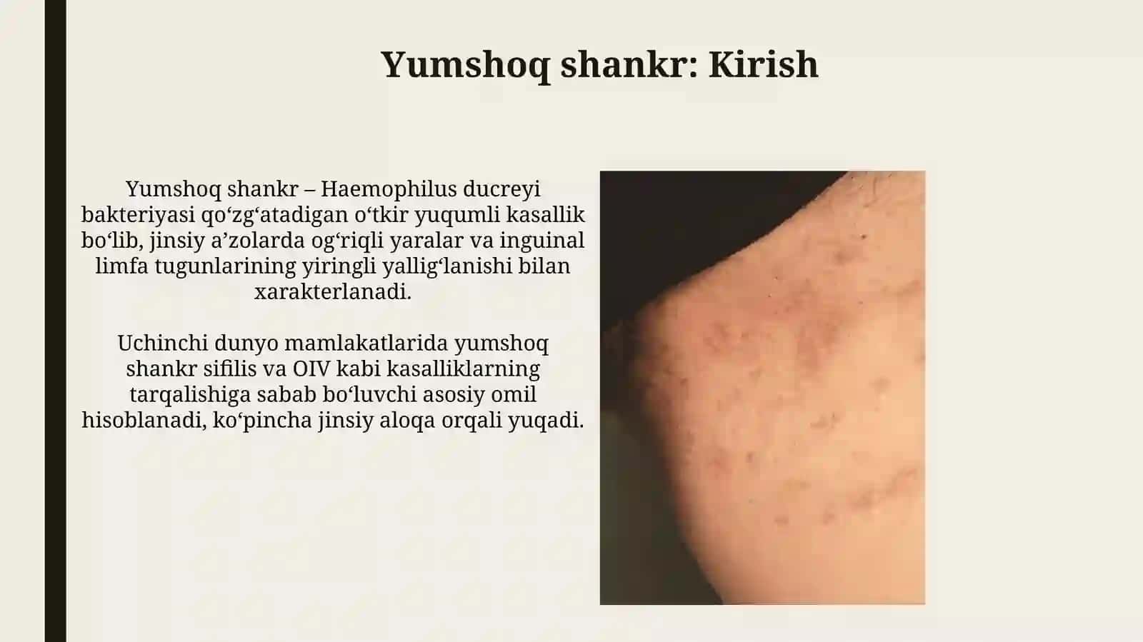 Yumshoq shankr va Limfogranulema venerum: Patogenez va Klinik Kechish 3