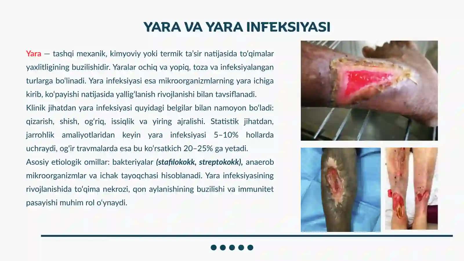 Yara infeksiyasi, sepsis va yaralar davolash prinsiplari 3