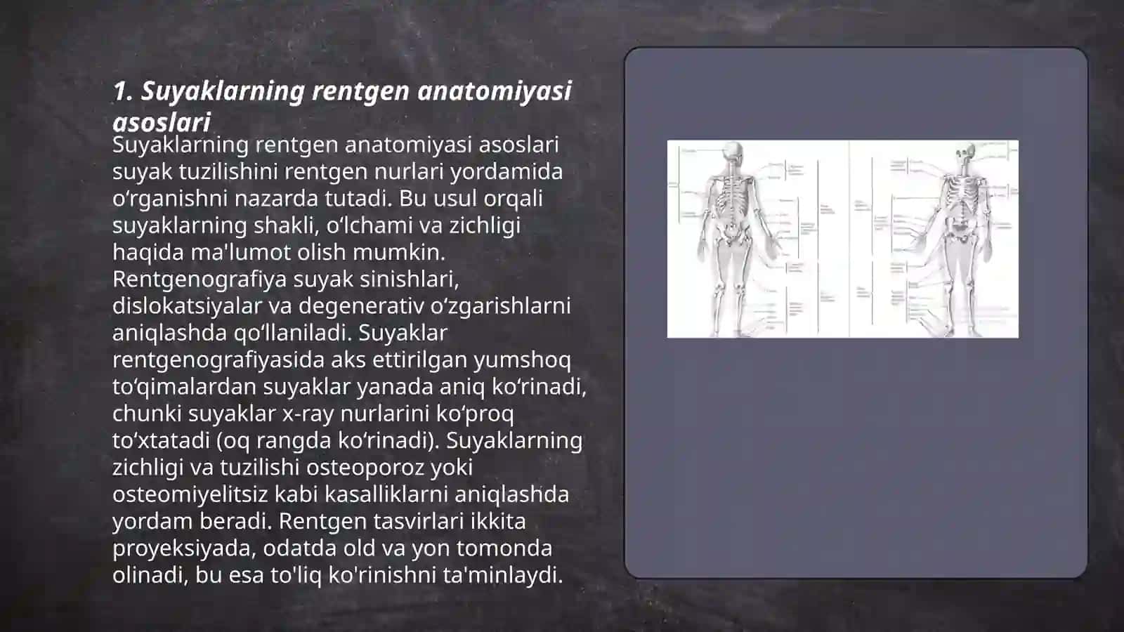 Skelet suyaklarning rentgen anatomiyasi.Suyaklarning anamalyalari 3