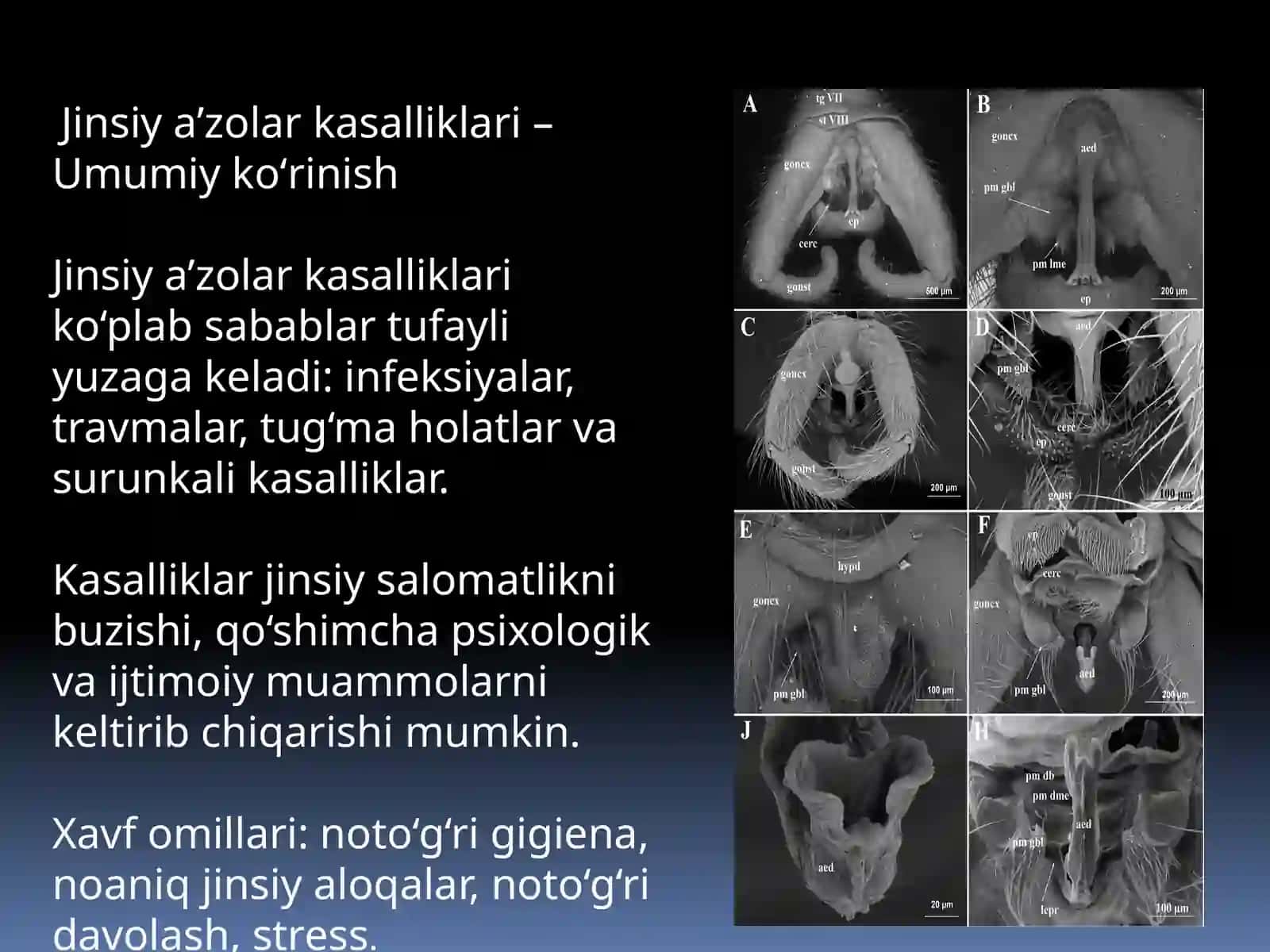 Erkaklar jinsiy xizmatlari va uretra kasalliklari 3