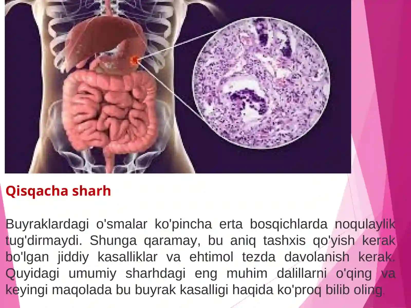 Buyrak O’smalari 3