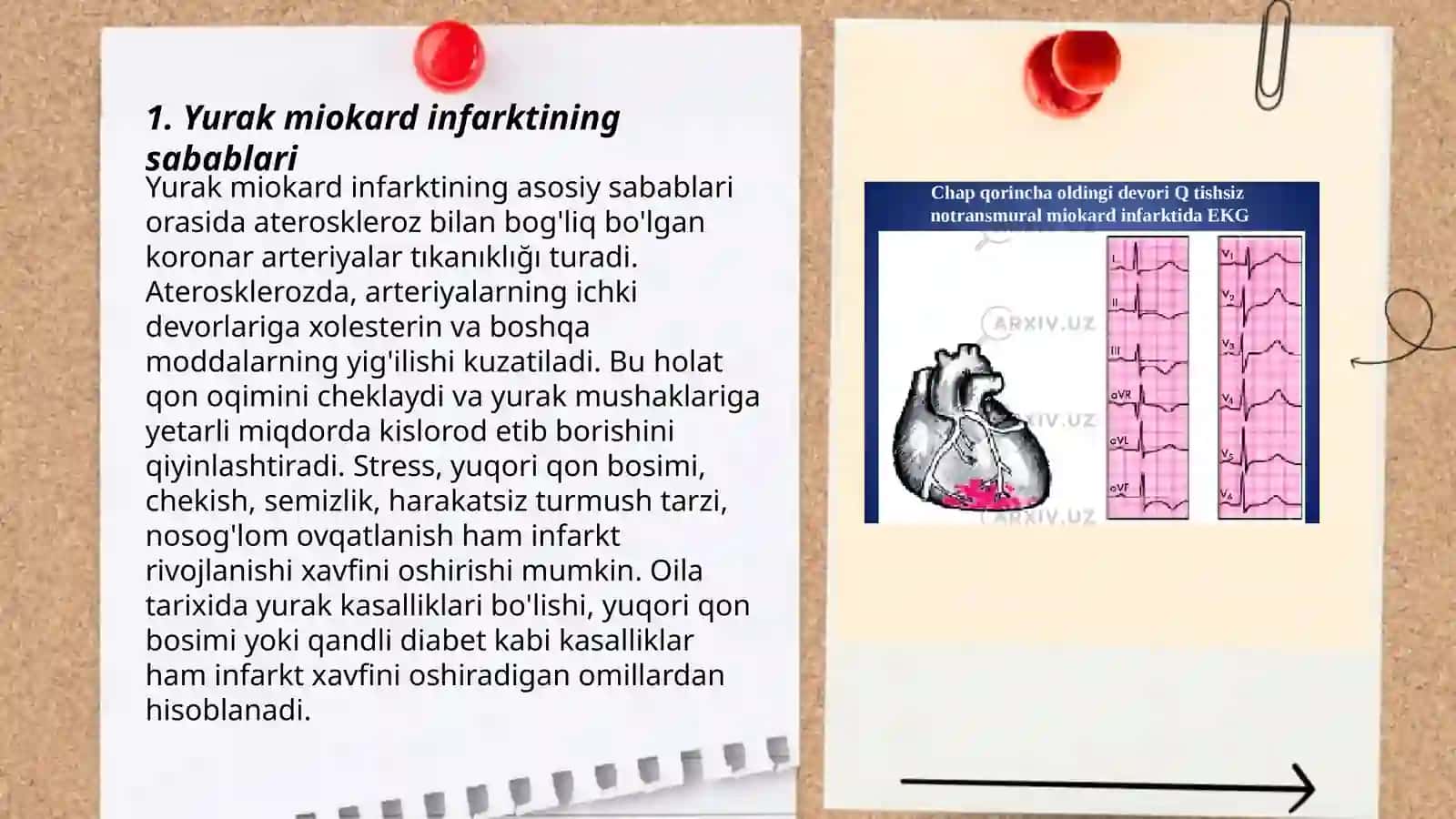 Yurak miokard infarkti 3