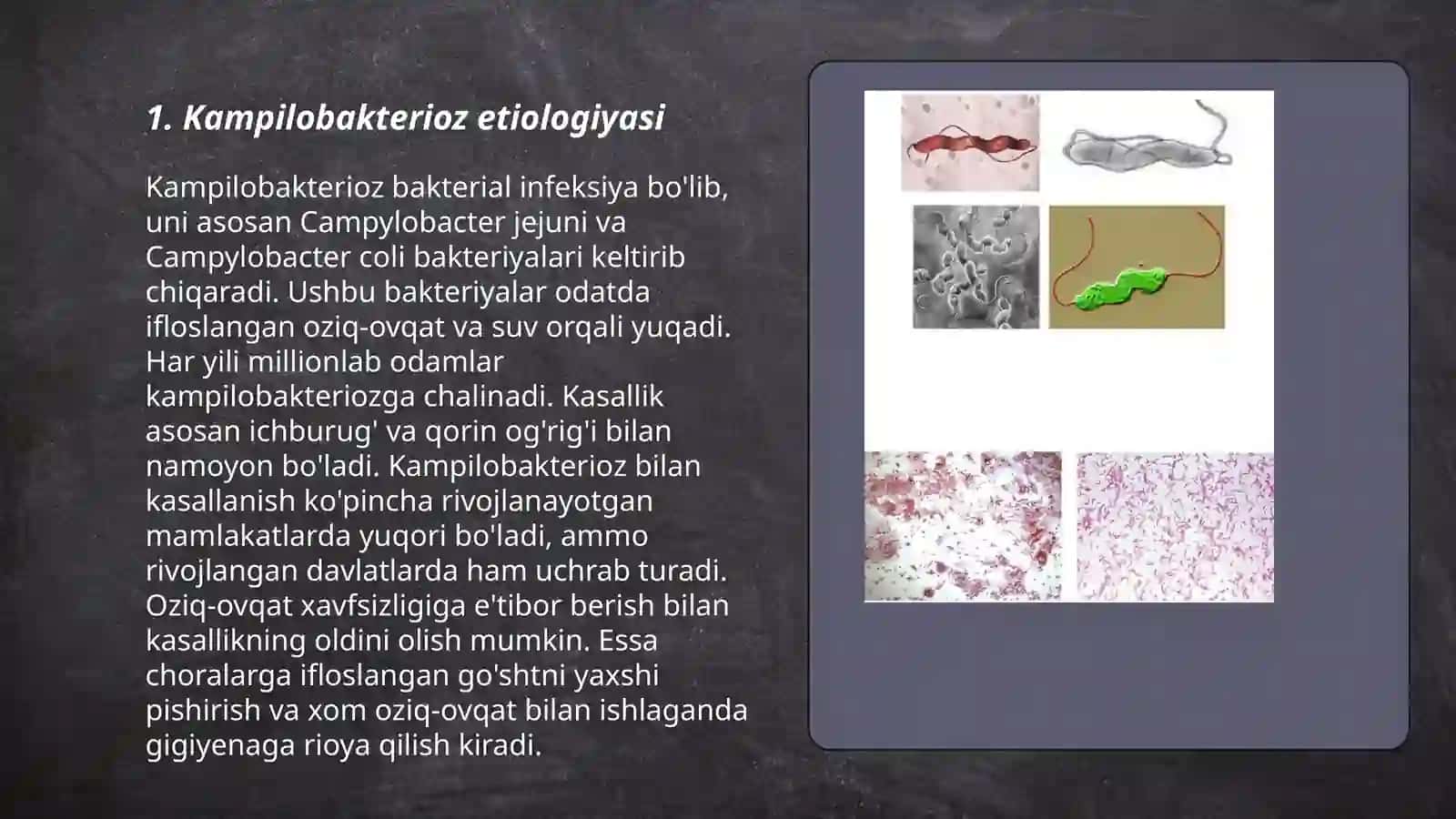 Kampilobakterioz etiologiya klinika epidemiologiya davolash diagnostikasi 3