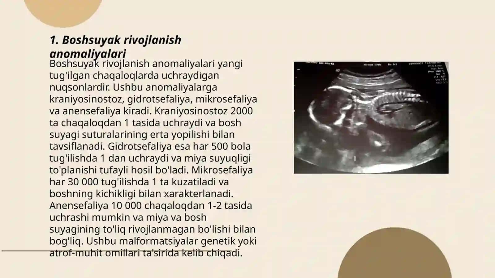 Skletning rivojlanish anomaliylari 3