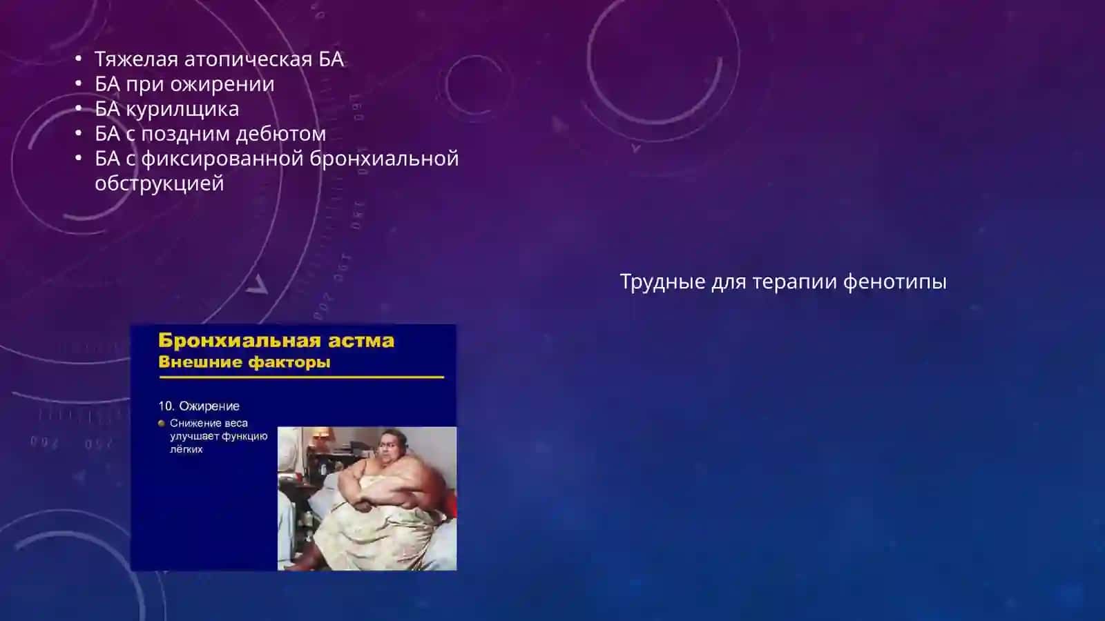 Бронхиальная астма 3
