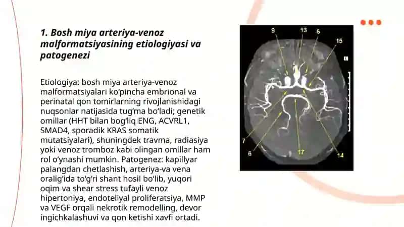 Bosh miya qon tomirlari arteriya venoz malfarmatsiyasi 3