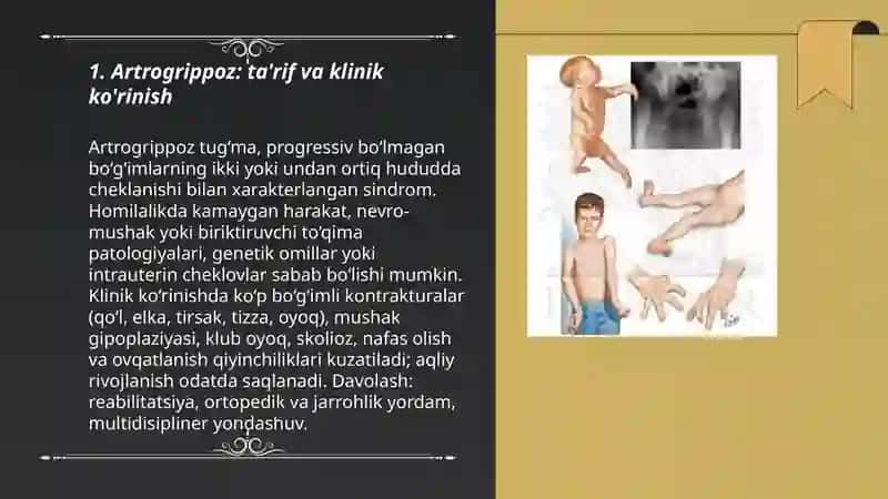 Artrogrippoz 3