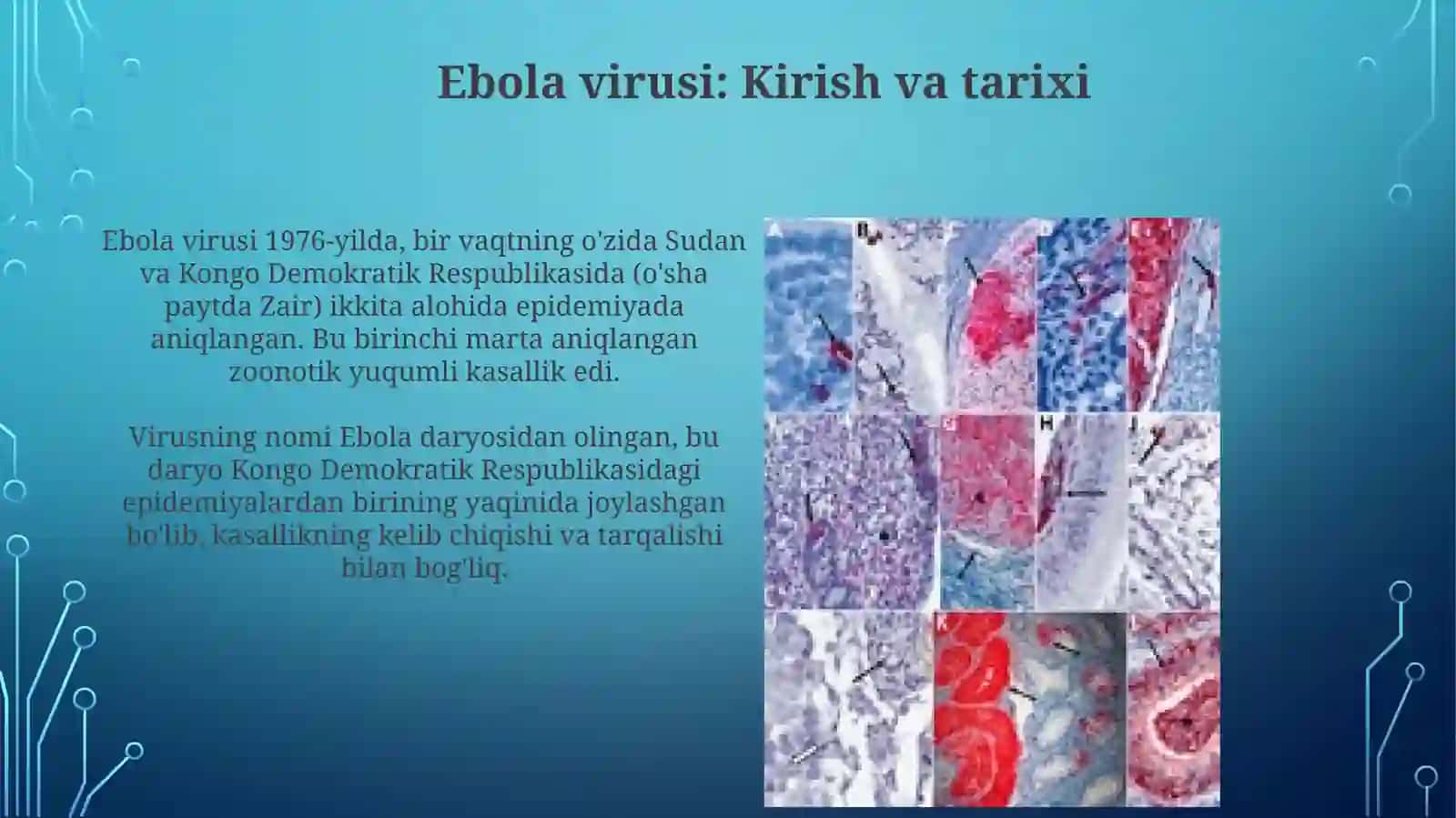 Ebola, lassa, zika viruslari, kasallik patogenezi, labaratoriyatashhisi 3