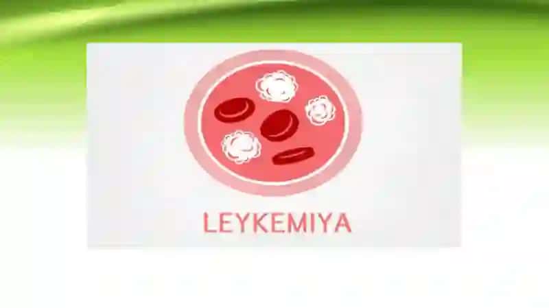 SURUNKALI LEYKOZ 3