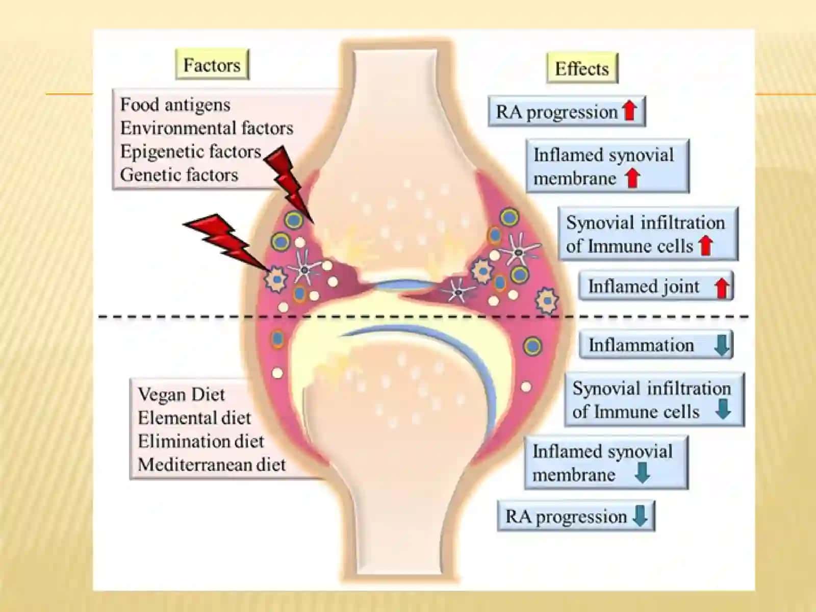 Endoarteriit xastaligini davolashda rekonstruktiv operatsiyalar 3