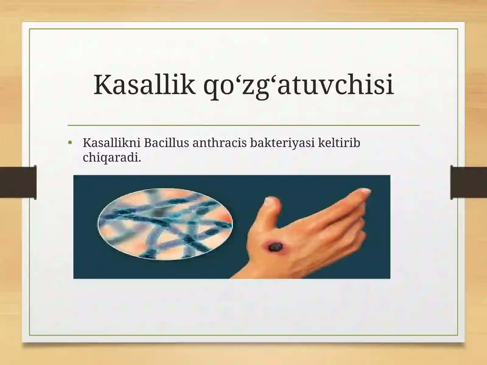 Kuydurgi kasalligi 3