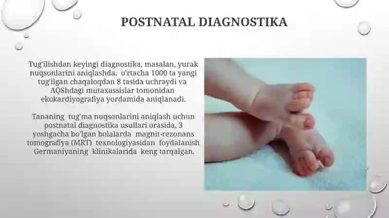 Umumiy tugʻma nuqsonlar zamonaviy diagnostikasi 3