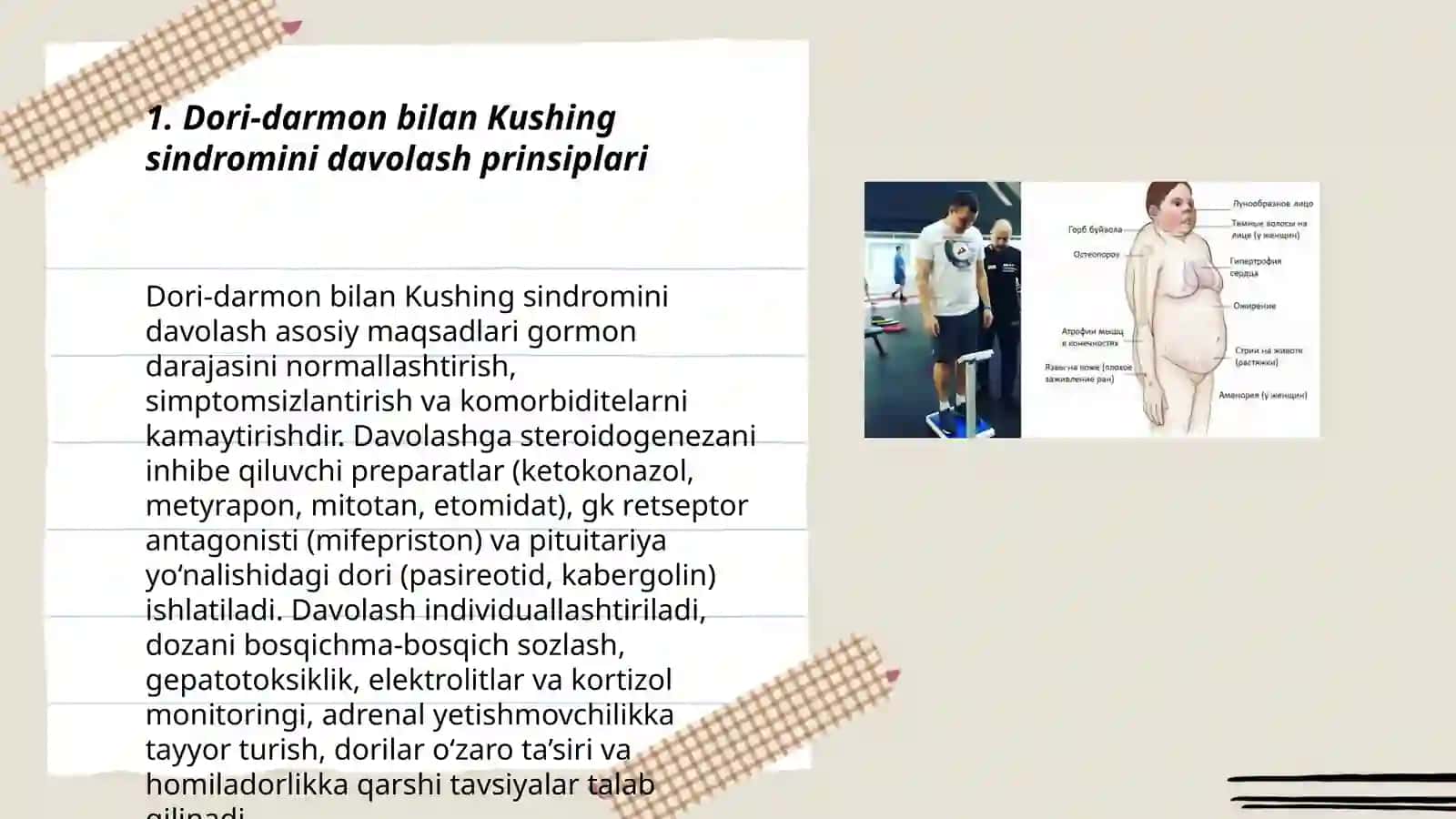Dori- darmon Kushing sindromi 3