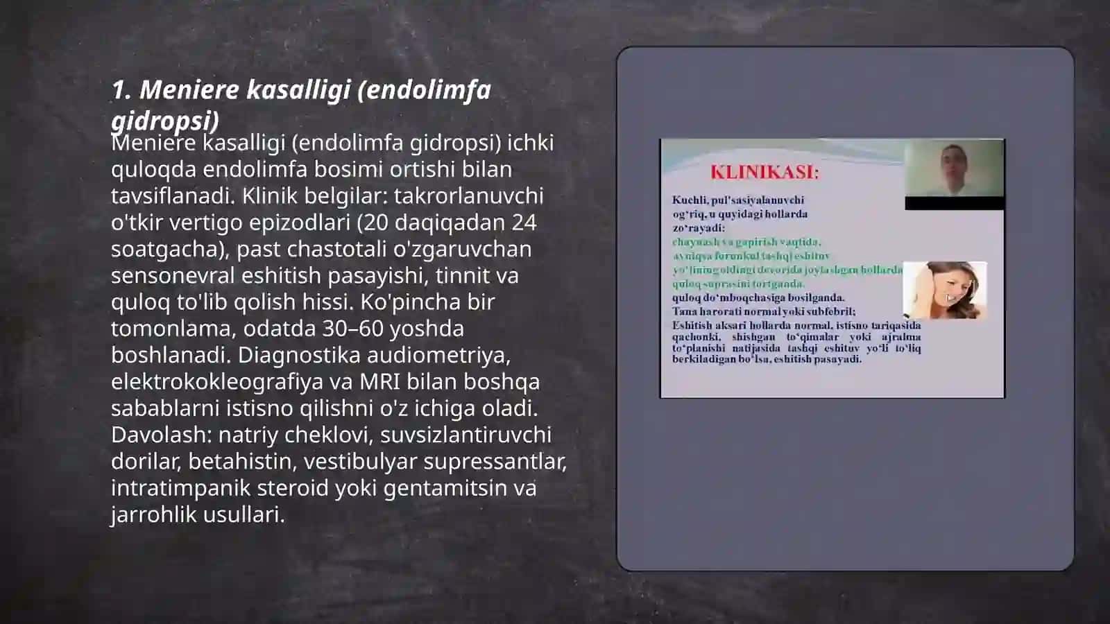 Ichki quloqning yiringsiz kasalliklari 3