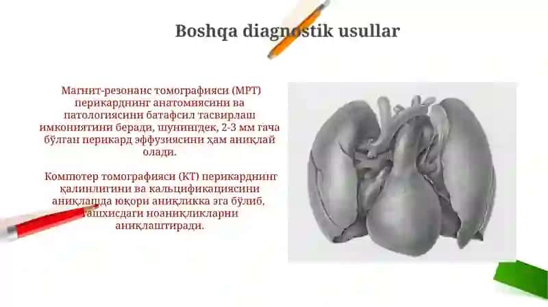 Perikard patologiyasida yurak funksiyasiyalarining buzilishi 3