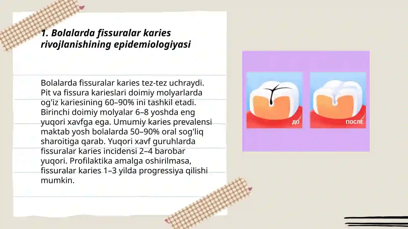 Bolalarda kariyes profilaktikasida tish fissuralarini germetizatsiya qilish va ularning ahamiyati 3