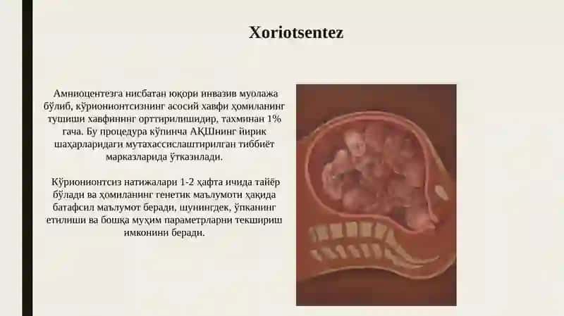 Xoriotsentez 3