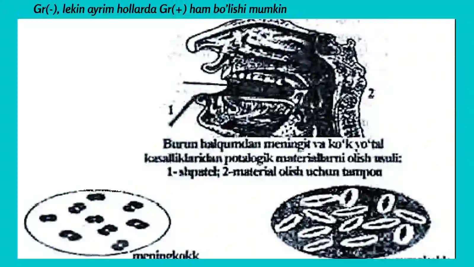 Meningokokklar va Pnevmokokklar kasalliklarining laboratoriya tashxisi 3