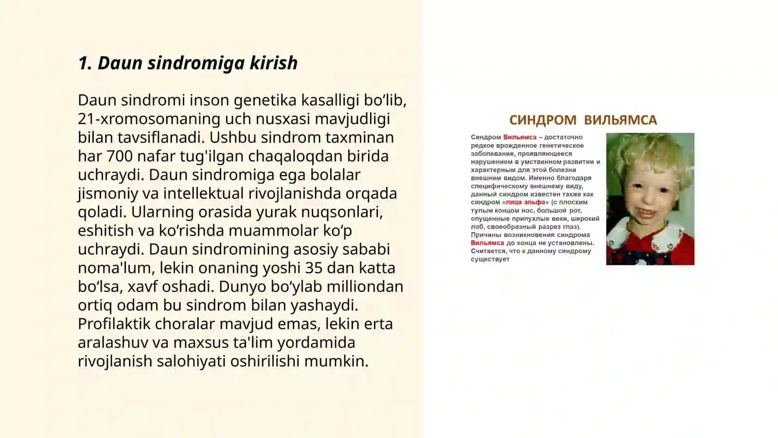 Daun sindromi 3