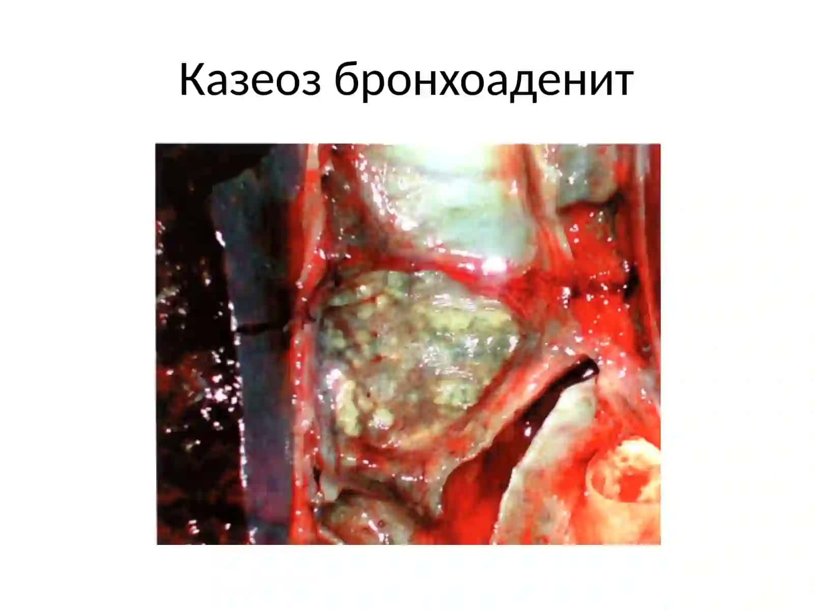 ФТИЗИАТРИЯБУЙИЧАРЕНТГЕНОГРАММАЛАР АЛЬБОМИ 3