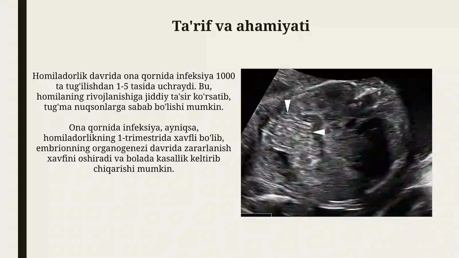 Homilaning ona qornida infeksiyasi 3