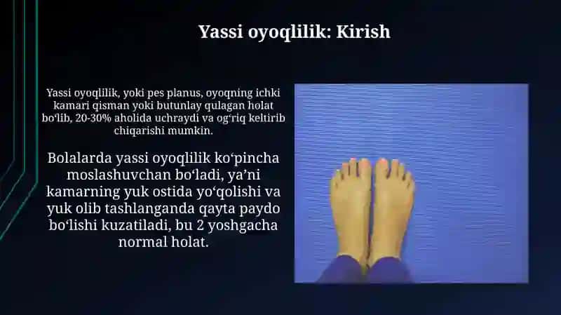 Yassi oyoqlilik va uning kelibchiqish sabablari 3