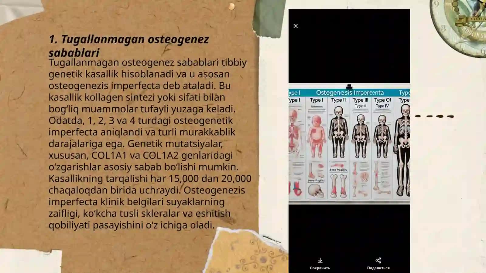 Tugallanmagan osteogenoz 3